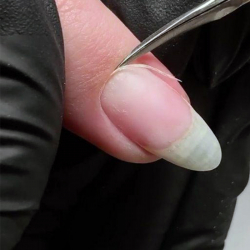 Böjd nagelbandssax Lexwo Medical Solingen 501 9,5cm