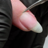 Böjd nagelbandssax Lexwo Medical Solingen 501 ✄